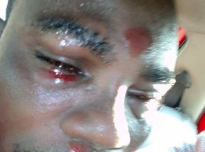 File photo: Communications Manager for the Independent Candidate Seth Oduro was assaulted